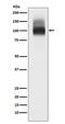 Solute Carrier Family 4 Member 1 (Diego Blood Group) antibody, M01146, Boster Biological Technology, Western Blot image 