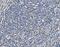 Superoxide Dismutase 2 antibody, M00349-3, Boster Biological Technology, Immunohistochemistry paraffin image 