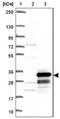 CKLF Like MARVEL Transmembrane Domain Containing 4 antibody, NBP1-84457, Novus Biologicals, Western Blot image 