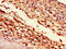 H13 antibody, LS-C670389, Lifespan Biosciences, Immunohistochemistry paraffin image 