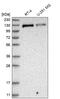 ATP-dependent DNA helicase Q4 antibody, HPA025821, Atlas Antibodies, Western Blot image 