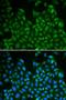 LIM Homeobox 8 antibody, LS-C331849, Lifespan Biosciences, Immunofluorescence image 