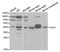Tachykinin Receptor 1 antibody, A5565, ABclonal Technology, Western Blot image 
