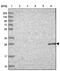 NBPF Member 12 antibody, NBP2-46734, Novus Biologicals, Western Blot image 