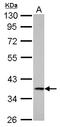 Cathepsin S antibody, LS-C185582, Lifespan Biosciences, Western Blot image 