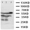 X-Linked Inhibitor Of Apoptosis antibody, orb47979, Biorbyt, Western Blot image 