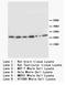 Sodium channel subunit beta-1 antibody, AP23388PU-N, Origene, Western Blot image 