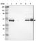 NFKB Inhibitor Epsilon antibody, HPA005941, Atlas Antibodies, Western Blot image 