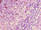 E3 ubiquitin-protein ligase ARIH2 antibody, CSB-PA002069LA01HU, Cusabio, Immunohistochemistry frozen image 