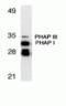 Acidic Nuclear Phosphoprotein 32 Family Member A antibody, TA306131, Origene, Western Blot image 