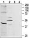 BKRB1 antibody, TA328718, Origene, Western Blot image 