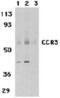 C-C Motif Chemokine Receptor 3 antibody, TA305940, Origene, Western Blot image 