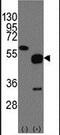 Neuronal pentraxin-2 antibody, PA5-12288, Invitrogen Antibodies, Western Blot image 