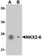 NK2 Homeobox 6 antibody, PA5-72763, Invitrogen Antibodies, Western Blot image 