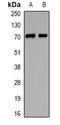 Rho GTPase Activating Protein 25 antibody, orb377932, Biorbyt, Western Blot image 