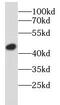 SRY-Box 17 antibody, FNab08124, FineTest, Western Blot image 
