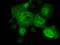 Cancer/Testis Antigen 1B antibody, LS-C797085, Lifespan Biosciences, Immunofluorescence image 