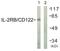 Interleukin-2 receptor subunit beta antibody, TA311640, Origene, Western Blot image 