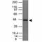 Epithelial Cell Adhesion Molecule antibody, V2692IHC-7ML, NSJ Bioreagents, Immunohistochemistry frozen image 