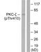 Protein Kinase C Zeta antibody, TA312044, Origene, Western Blot image 