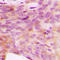 NADH:Ubiquinone Oxidoreductase Subunit V3 antibody, LS-C356215, Lifespan Biosciences, Immunohistochemistry paraffin image 