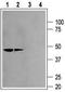 Potassium Voltage-Gated Channel Subfamily J Member 12 antibody, TA328946, Origene, Western Blot image 