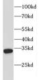F-Box And Leucine Rich Repeat Protein 15 antibody, FNab03034, FineTest, Western Blot image 