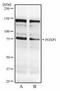Forkhead Box P1 antibody, TA336483, Origene, Western Blot image 