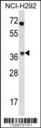 Olfactory Receptor Family 4 Subfamily N Member 2 antibody, 56-315, ProSci, Western Blot image 