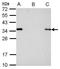 S-tag epitope tag antibody, GTX128060, GeneTex, Immunoprecipitation image 