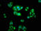 WASP Family Member 2 antibody, LS-C672891, Lifespan Biosciences, Immunofluorescence image 