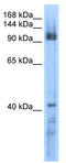 ATP-dependent DNA helicase Q5 antibody, TA341562, Origene, Western Blot image 