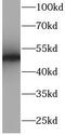 CD2 Molecule antibody, FNab01437, FineTest, Western Blot image 
