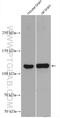 Gamma-Aminobutyric Acid Type B Receptor Subunit 2 antibody, 27567-1-AP, Proteintech Group, Western Blot image 