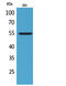 Growth Differentiation Factor 5 antibody, STJ96667, St John