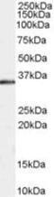 E3 ubiquitin-protein ligase CHIP antibody, MBS420984, MyBioSource, Western Blot image 