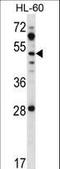 Zinc finger protein ZIC 1 antibody, LS-C160791, Lifespan Biosciences, Western Blot image 