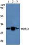 Steroid 5 Alpha-Reductase 1 antibody, A03464-1, Boster Biological Technology, Western Blot image 