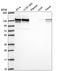 RAB GTPase Activating Protein 1 antibody, HPA072273, Atlas Antibodies, Western Blot image 