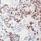 5'-3' Exoribonuclease 2 antibody, LS-C368635, Lifespan Biosciences, Immunohistochemistry paraffin image 