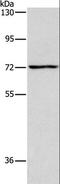 Very long-chain specific acyl-CoA dehydrogenase, mitochondrial antibody, LS-C402594, Lifespan Biosciences, Western Blot image 
