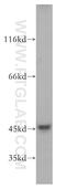 Mitogen-Activated Protein Kinase 8 antibody, 51151-1-AP, Proteintech Group, Western Blot image 