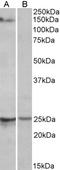 RNA Binding Motif Protein 20 antibody, LS-C139674, Lifespan Biosciences, Western Blot image 