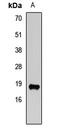 Vesicle Associated Membrane Protein 2 antibody, orb411980, Biorbyt, Western Blot image 