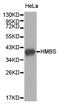 Porphobilinogen deaminase antibody, LS-C192793, Lifespan Biosciences, Western Blot image 