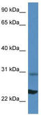 Ribosomal Protein L17 antibody, TA335160, Origene, Western Blot image 