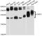Cysteine Rich Protein 2 antibody, A9038, ABclonal Technology, Western Blot image 