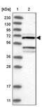 Dual Specificity Tyrosine Phosphorylation Regulated Kinase 4 antibody, PA5-55758, Invitrogen Antibodies, Western Blot image 