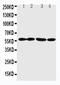 Angiopoietin Like 1 antibody, LS-C312643, Lifespan Biosciences, Western Blot image 