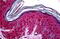 Tumor Susceptibility 101 antibody, MBS246028, MyBioSource, Immunohistochemistry frozen image 